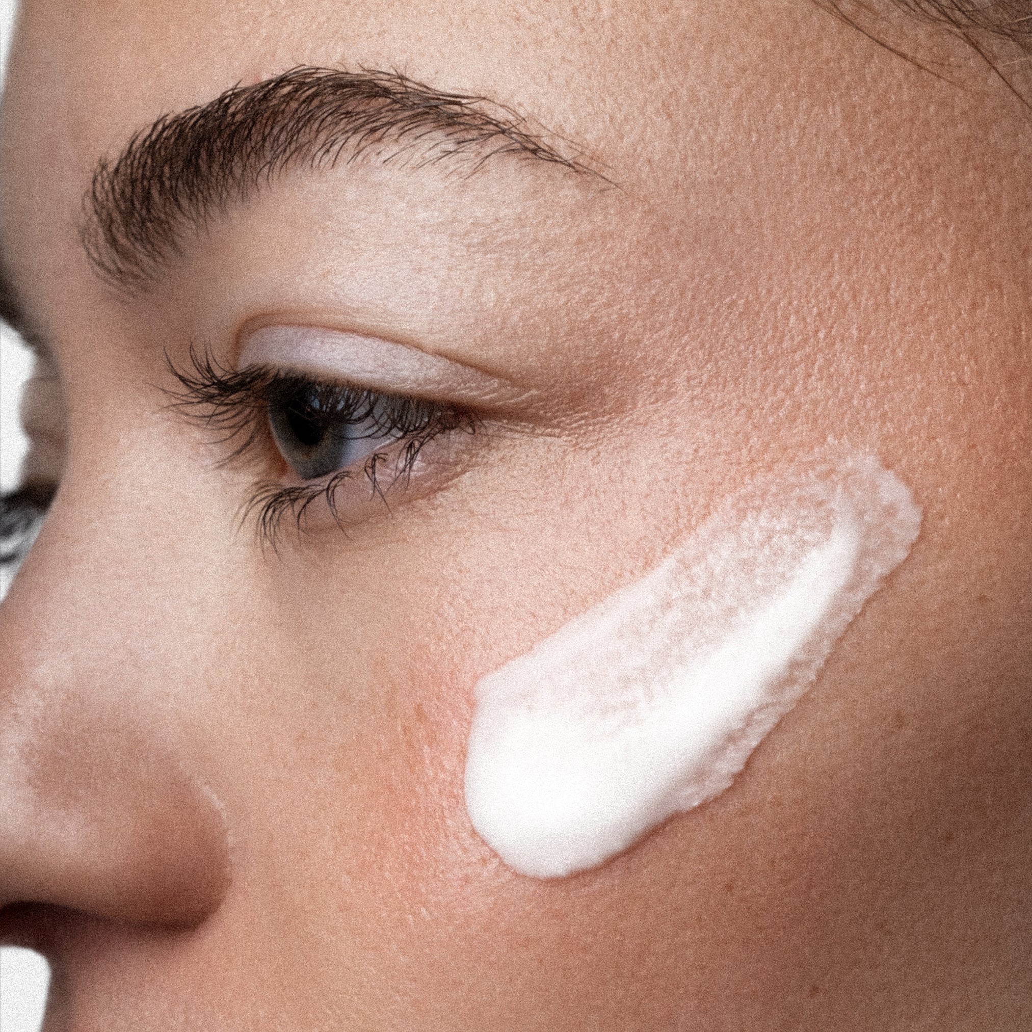 10% Azelaic Acid + PHA Skin Serum | Best Anti Aging Serum – ANFISA