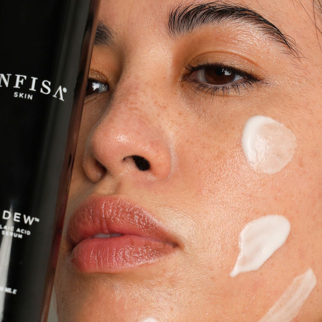 I Tested Popular Redness-Reducing Products (Again) to See if They Could Soothe My Rosacea